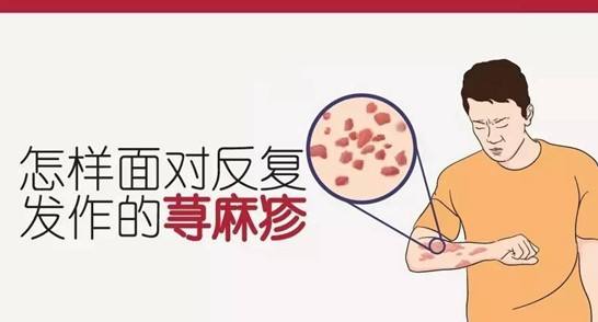 患了荨麻疹为什么会痒呢